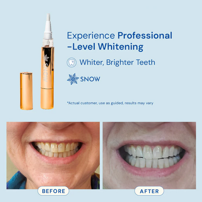 Snow Glow™ Whitening Pen